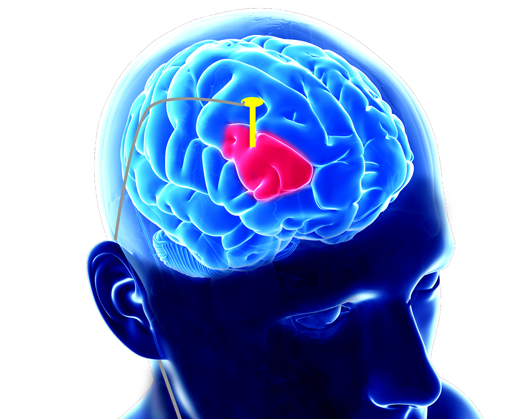 Expert in the diagnosis of NEUROLOGICAL BASED PROBLEMS